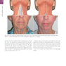 The Art and Science of Facelift Surgery: A Video Atlas 1st Edicion 2019