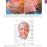 The Art and Science of Facelift Surgery: A Video Atlas 1st Edicion 2019