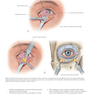 Core Procedures in Plastic Surgery 2nd Edition 2020