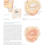 Colour Atlas of Ophthalmic Plastic Surgery 4th Edition2017
