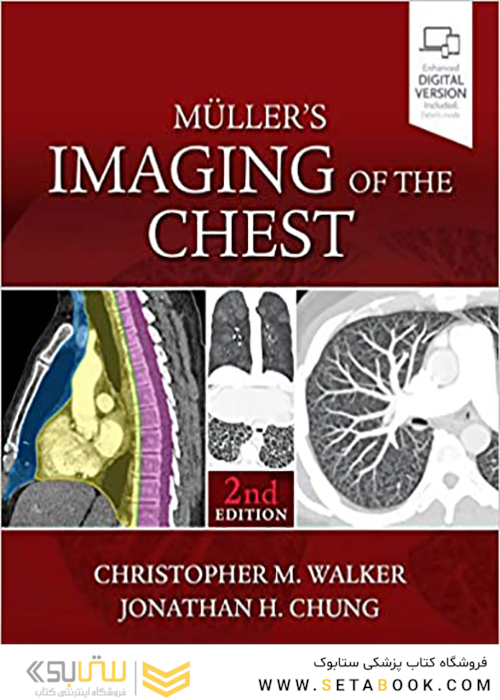 Muller’s Imaging of the Chest, 2nd Edition2018