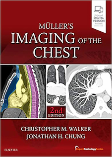 عکس Muller’s Imaging of the Chest, 2nd Edition2018