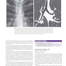 Muller’s Imaging of the Chest, 2nd Edition2018