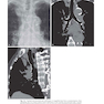 Muller’s Imaging of the Chest, 2nd Edition2018