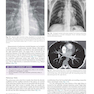 Muller’s Imaging of the Chest, 2nd Edition2018