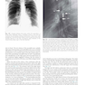 Muller’s Imaging of the Chest, 2nd Edition2018