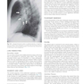 Muller’s Imaging of the Chest, 2nd Edition2018