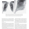 Muller’s Imaging of the Chest, 2nd Edition2018