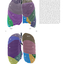 Muller’s Imaging of the Chest, 2nd Edition2018