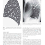 Muller’s Imaging of the Chest, 2nd Edition2018