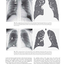 Muller’s Imaging of the Chest, 2nd Edition2018