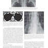 Muller’s Imaging of the Chest, 2nd Edition2018