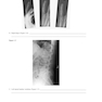 Workbook for Radiographic Image Analysis 5th Edicion