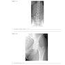 Workbook for Radiographic Image Analysis 5th Edicion