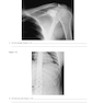 Workbook for Radiographic Image Analysis 5th Edicion