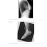 Workbook for Radiographic Image Analysis 5th Edicion