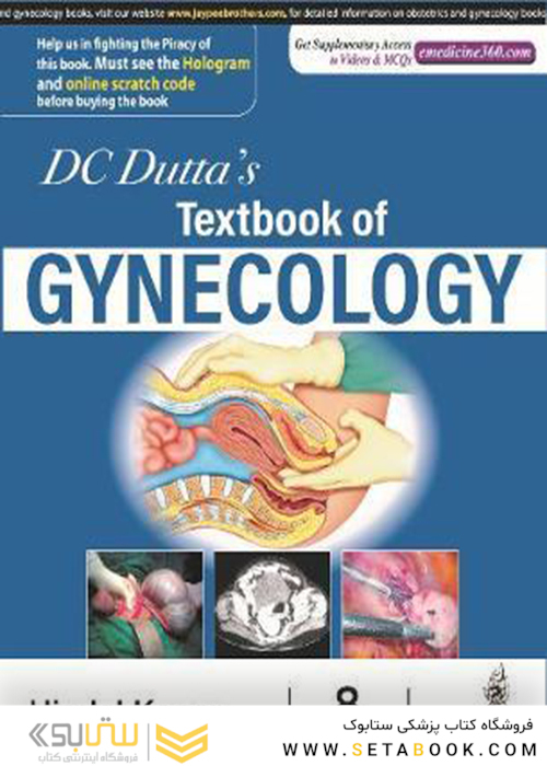 DC Dutta’s Textbook of Gynecology, 8th Edition2020