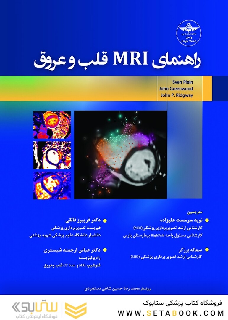 راهنمای MRI قلب و عروق