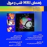 راهنمای MRI قلب و عروق