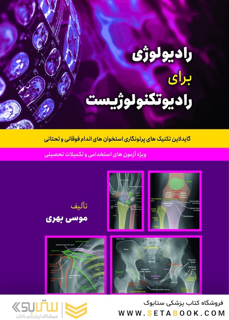 رادیولوژی بری رادیوتکنولوژیست ( گایدلاین تکنیک های پرتونگاری استخوان اندام فوقانی و تحتانی )