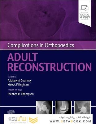 Complications in Orthopaedics: Adult Reconstruction 1st Edición