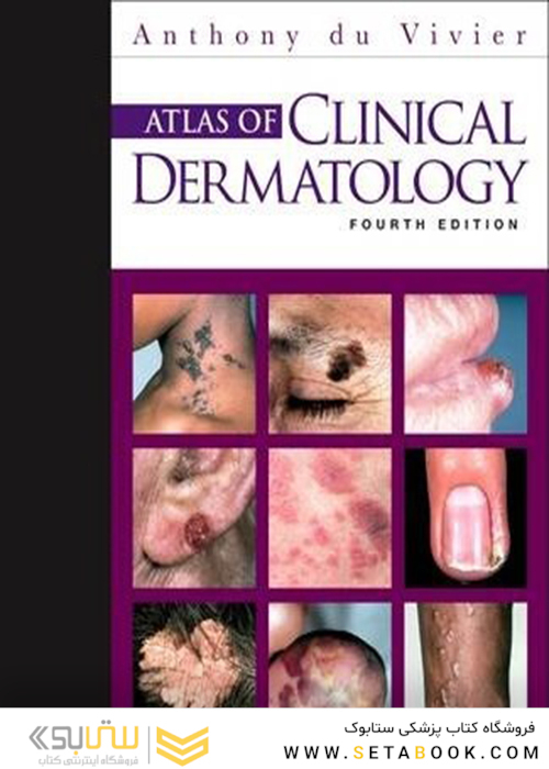 Atlas of Clinical Dermatology, 4th Edition