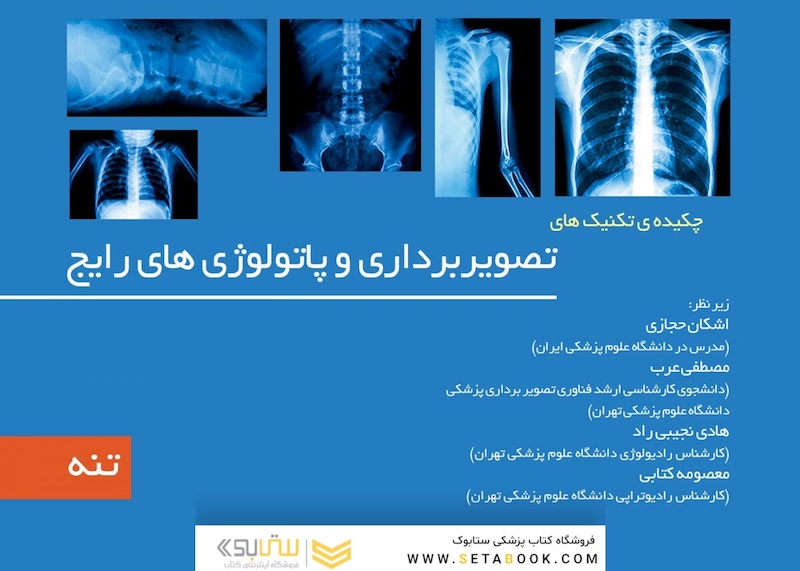 چکیده تکینک های تصویربرداری و پاتولوژی رایج جلد3 ( تنه )