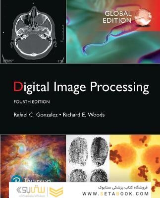 Digital Image Processing, Global Edition