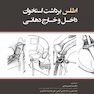 اطلس برداشت استخوان داخل و خارج دندان