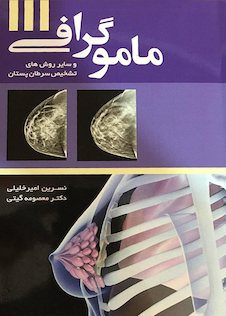 عکس ماموگرافی وسایر روش های تشخیص سرطان پستان
