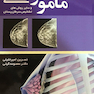 ماموگرافی وسایر روش های تشخیص سرطان پستان