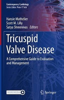 عکس Tricuspid Valve Disease: A Comprehensive Guide to Evaluation and Management (Contemporary Cardiology) 1st ed. 2022 Edition