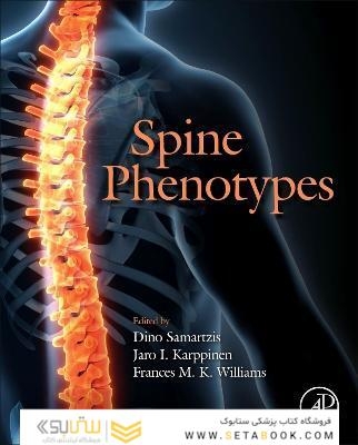 Spine Phenotypes