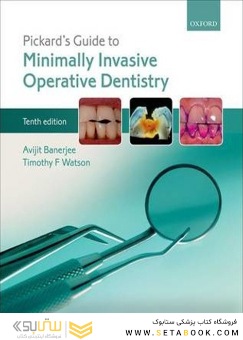 Minimally Invasive Operative Dentistry 10th Edition2015