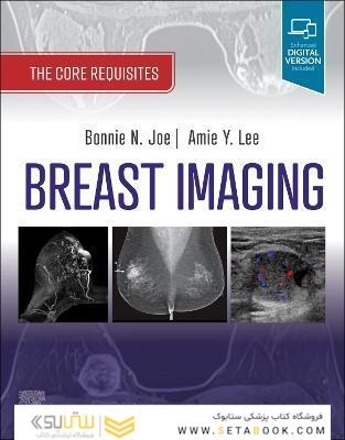 Breast Imaging : The Core Requisites 4th Edition