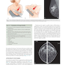 Breast Imaging : The Core Requisites 4th Edition
