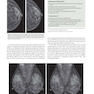 Breast Imaging : The Core Requisites 4th Edition