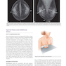 Breast Imaging : The Core Requisites 4th Edition