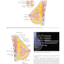 Breast Imaging : The Core Requisites 4th Edition