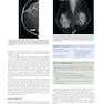 Breast Imaging : The Core Requisites 4th Edition