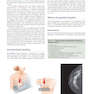 Breast Imaging : The Core Requisites 4th Edition