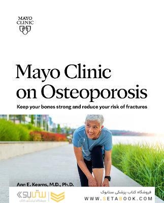 Mayo Clinic on Osteoporosis: Keep your bones strong and reduce your risk of fractures Paperback – October 19, 2021
