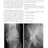 McRae’s Elective Orthopaedics 7th Edicion