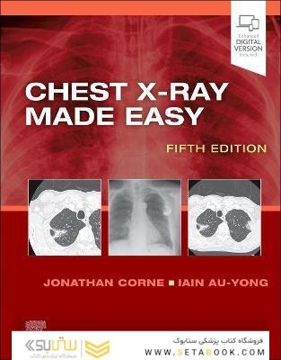 Chest X-Ray Made Easy 5th Edition