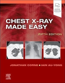 عکس Chest X-Ray Made Easy 5th Edition