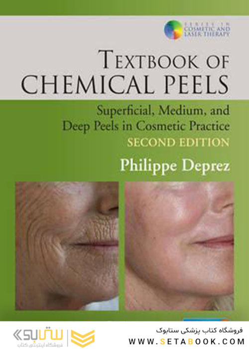 Textbook of Chemical Peels : Superficial, Medium, and Deep Peels in Cosmetic Practice