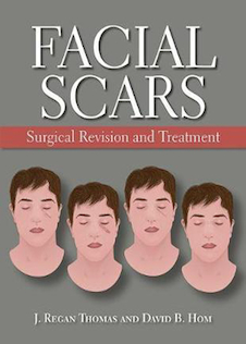 عکس Facial Scars: Surgical Revision and Treatment2017