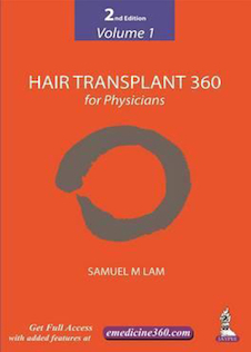 عکس Hair Transplant 360 for Physicians 2nd Edition2019
