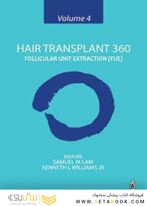 Hair Transplant 360: Follicular Unit Extraction (FUE)2019