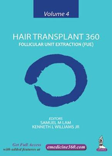 عکس Hair Transplant 360: Follicular Unit Extraction (FUE)2019